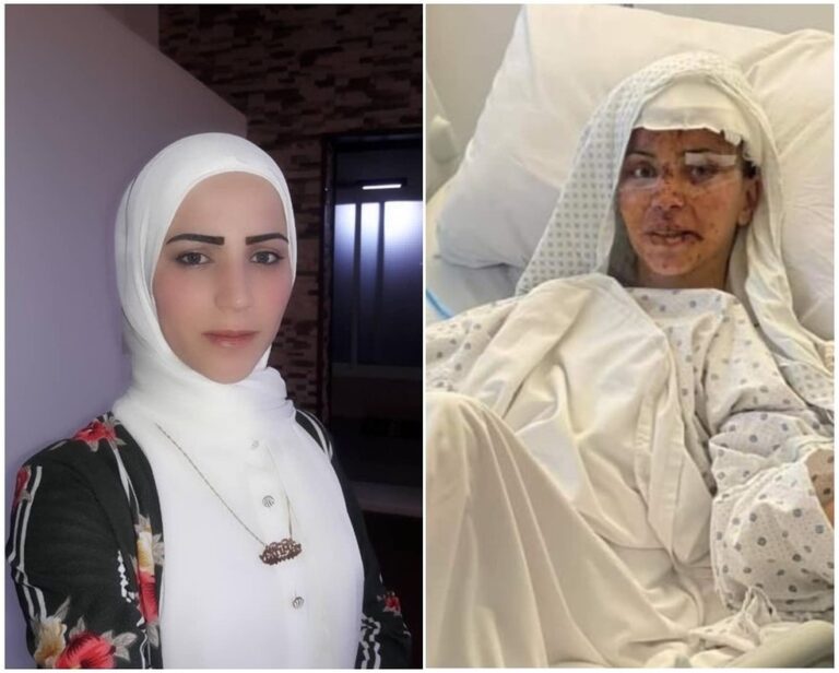 Brasileira ferida no Líbano tem melhora, e família mostra primeira foto dela no hospital