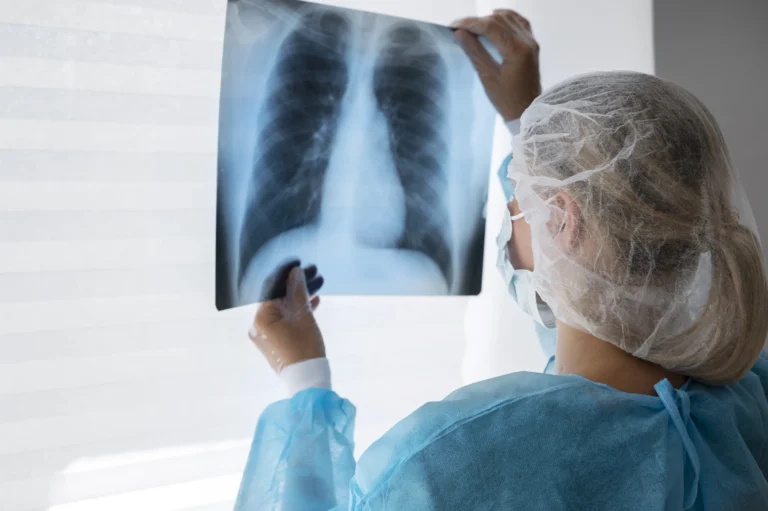 Novo tratamento para câncer de pulmão recebe aval da Anvisa
